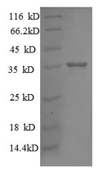 30S ribosomal protein S18 (rpsR), Escherichia coli, recombinant