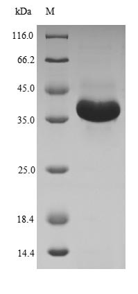 Membrane-bound transcription factor site-1 protease (MBTPS1), partial, human, recombinant