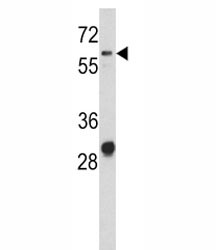 Anti-CD166