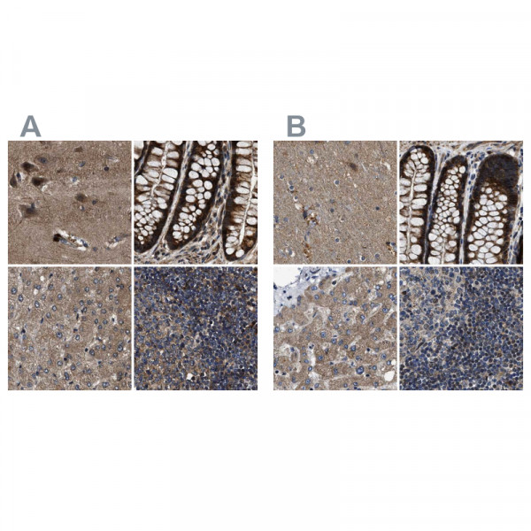 Anti-PPWD1