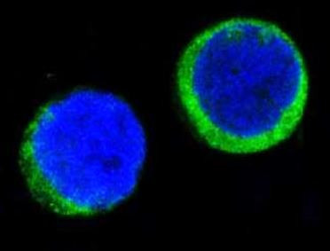 Anti-Ferritin