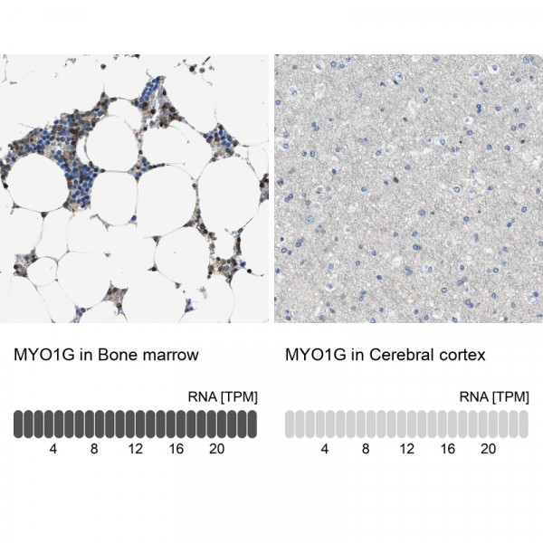 Anti-MYO1G