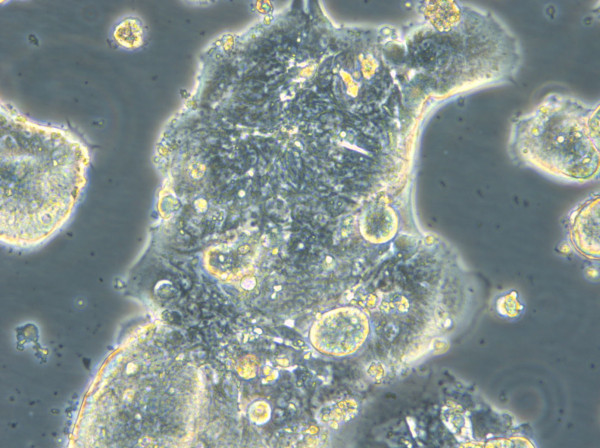 HROC309 Cells