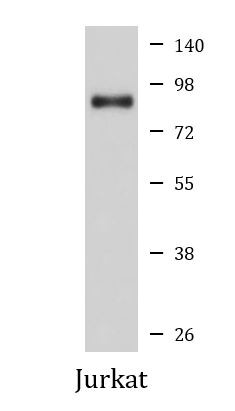 Anti-phospho-PKC alpha (Thr638)