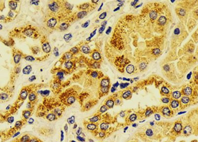 Anti-HMGCL