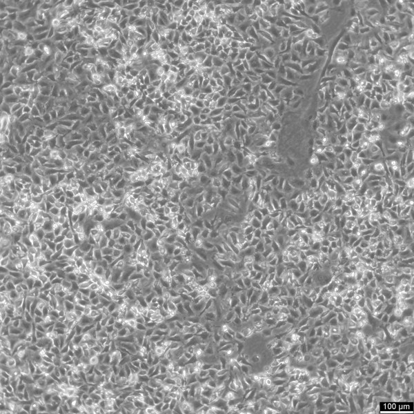 B-CPAP Cells