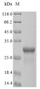 Outer membrane protein A (ompA), partial, Klebsiella pneumoniae, recombinant