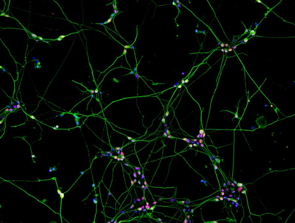 Human Pluripotent Stem Cell Derived-Sensory Neurons