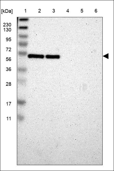 Anti-RBM22