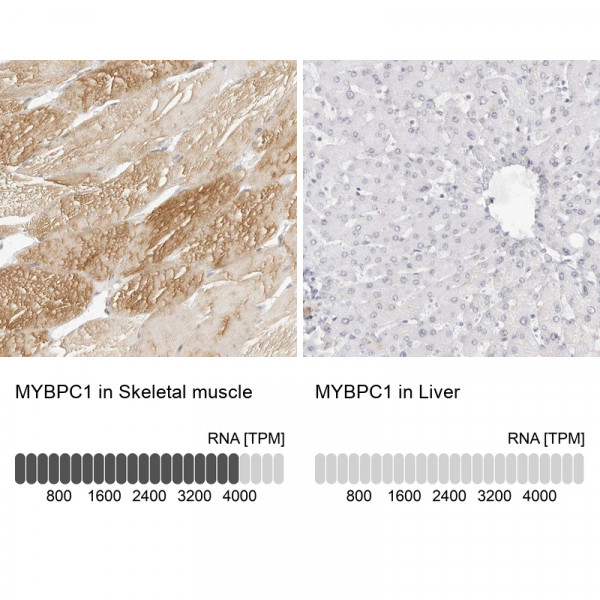 Anti-MYBPC1