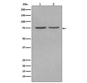 Anti-Tissue-nonspecific Alkaline Phosphatase / ALPL, clone DBF-1