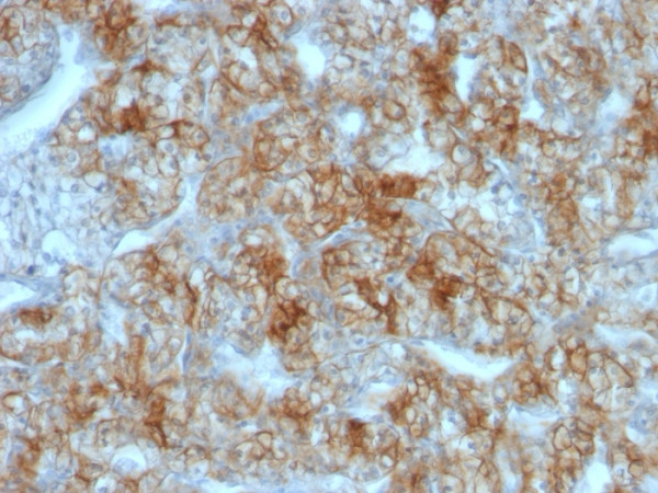 Anti-Ksp-Cadherin (Kidney-Specific Cadherin) / CDH16, clone CDH16/1071