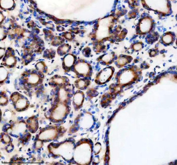 Anti-TMED1 / Transmembrane emp24 domain-containing protein 1