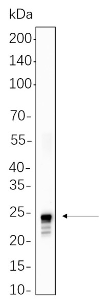 Anti-Recombinant Histone H2A (Ubiquityl Lys119), clone 9C5