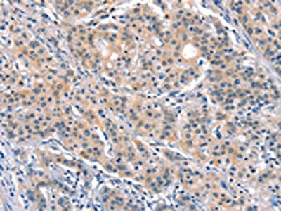 Anti-ELOVL6