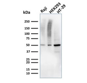 Anti-MMP3 / Matrix Metalloproteinase 3, clone MMP3/2655