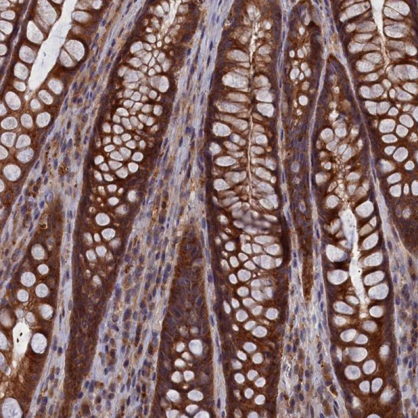 Anti-CACTIN