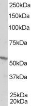 Anti-Retinoid X Receptor beta, Internal