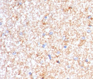 Anti-Serum Amyloid P, clone SMPC-1