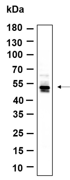Anti-Recombinant Phospho-CaMKII alpha, beta (Thr286), clone 6H4