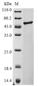 Nucleoprotein (N), Bovine coronavirus, recombinant