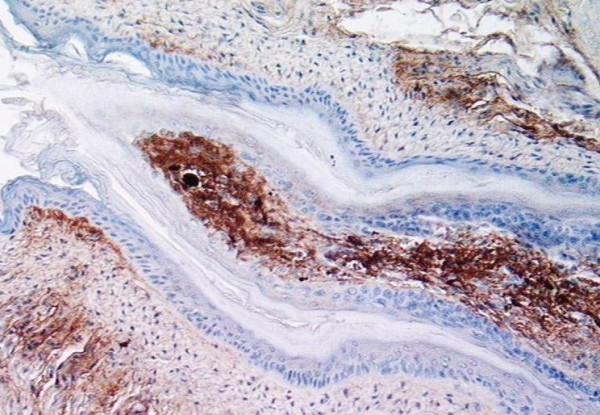 Anti-Fibronectin