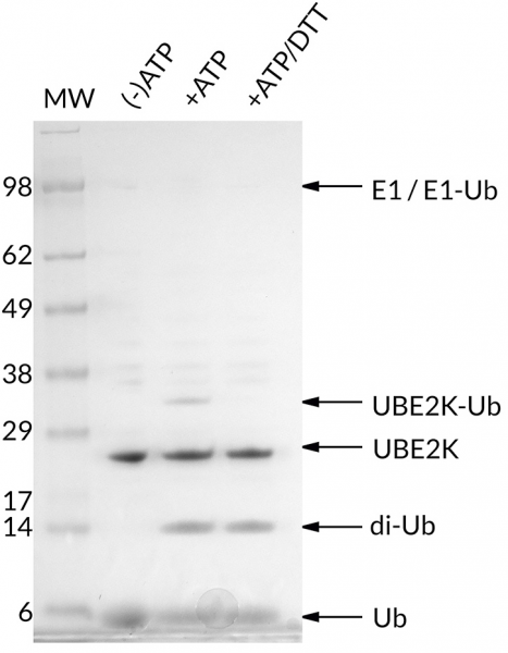UbcH1 [UBE2K, E2-25K] (human) (rec.) (His)
