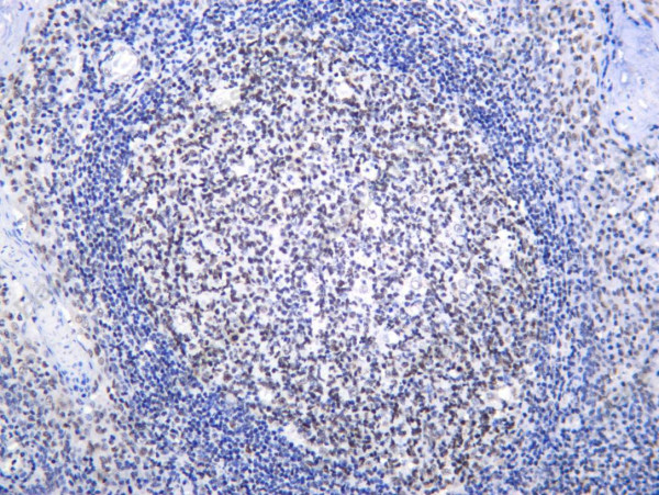 Anti-Recombinant MBD2, clone C112603