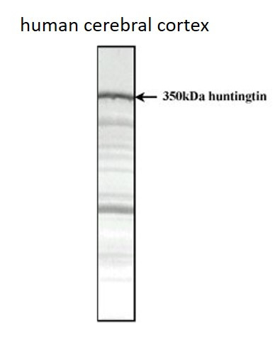 Anti-Huntingtin, clone HDC8A4