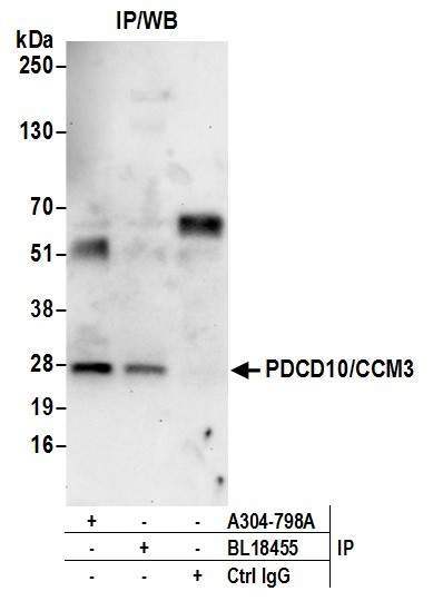 Anti-PDCD10/CCM3