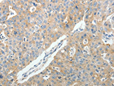 Anti-PTGDS