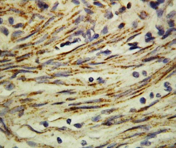 Anti-MMP16