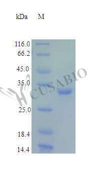Fructose-2,6-bisphosphatase TIGAR protein (TIGAR) (Active), human, recombinant