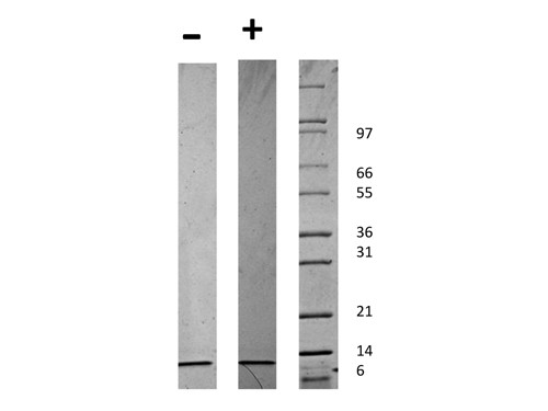 Beta-cell Attracting Chemokine 1 (CXCL13)