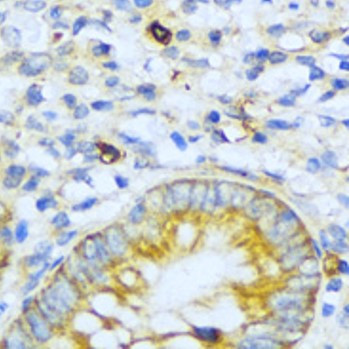 Anti-TGFBR2 / TGF beta Receptor II