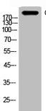 Anti-C4A/C4B