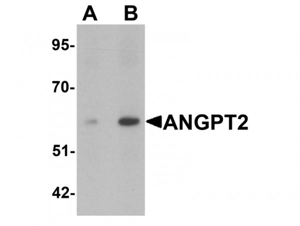 Anti-Angiopoietin-2