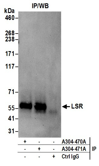 Anti-LSR
