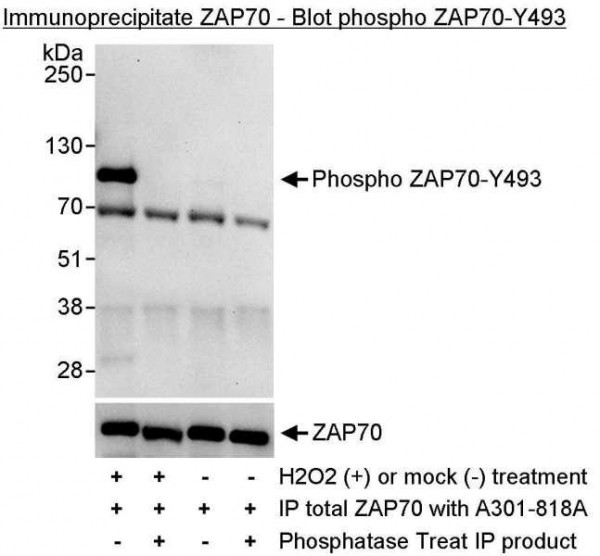 Anti-phospho-ZAP70 (Tyr493)