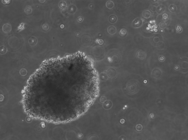 B-LCL-HROC60 Cells