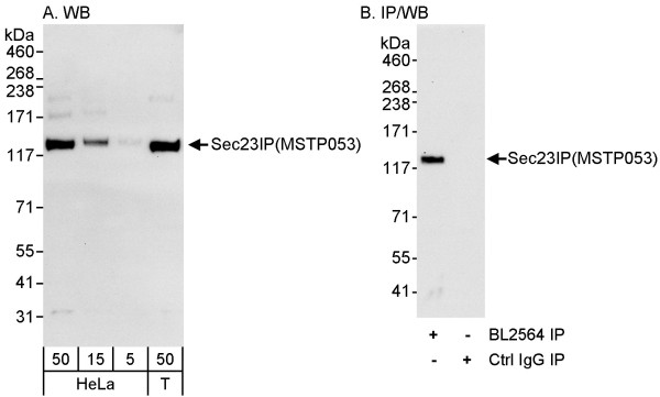 Anti-Sec23IP/MSTP053