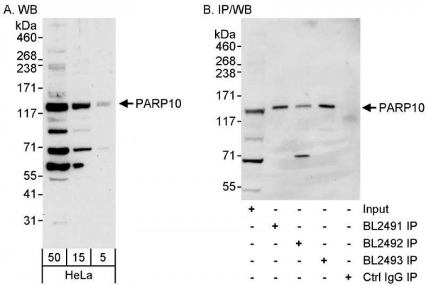 Anti-PARP10