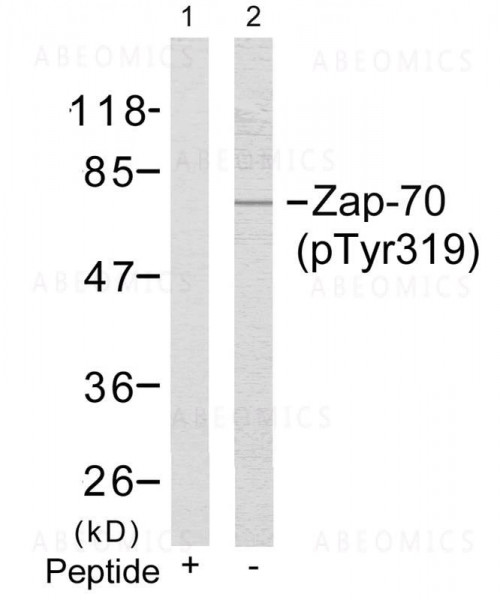 Anti-phospho-Zap-70 (Tyr319)