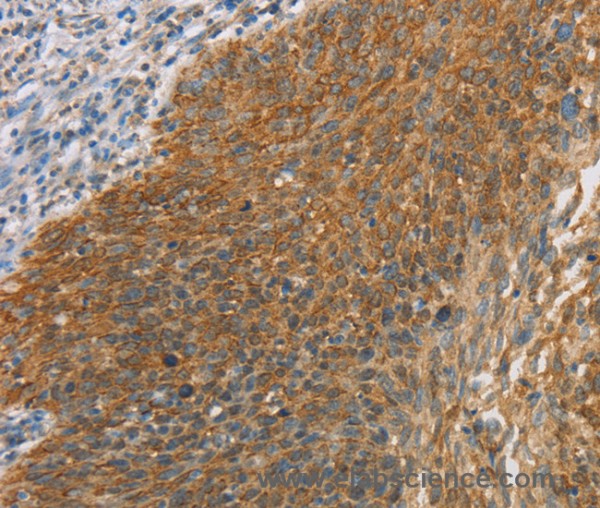 Anti-MAPK6