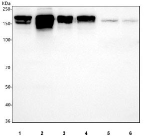 Anti-CLIP1 / CLIP170 / CAP-GLY domain containing linker protein 1, clone 29C06