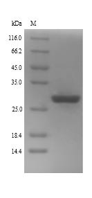 Zinc finger protein GLI2 (GLI2), partial, human, recombinant