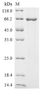N-myc-interactor (Nmi), mouse, recombinant