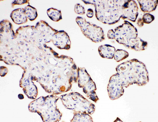 Anti-Aquaporin 6