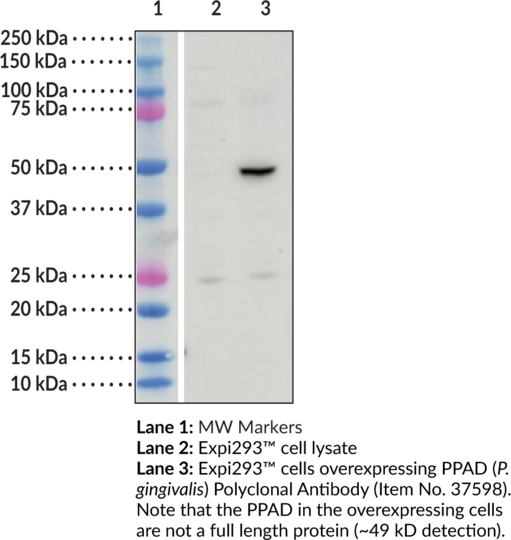 Anti-PPAD (Porphyromonas gingivalis)