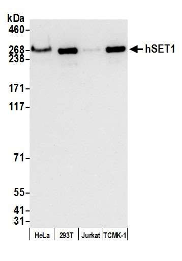 Anti-hSET1 Recombinant Monoclonal